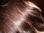 волосы после применения дегтярного шампуня