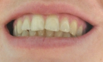 зубы после использования Паста зубная "кедровая", Рецепты бабушки Агафьи