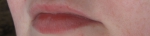 Детская зимняя гигиеническая помада «Морозко», губы до нанесения