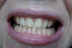 Зубы стали не сильно белее, но чище - однозначно! Фото на следующее утро после чистки