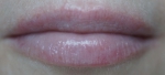 Бальзам для губ Uriage Bariederm Levres - губы с нанесенным бальзамом через 1,5 дня после начала лечения