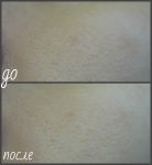 Фото до и после применения ВВ-крема