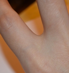 Маленький шрамик между пальцами на руке