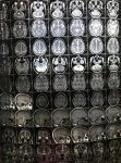 МРТ головы - обследование клиники