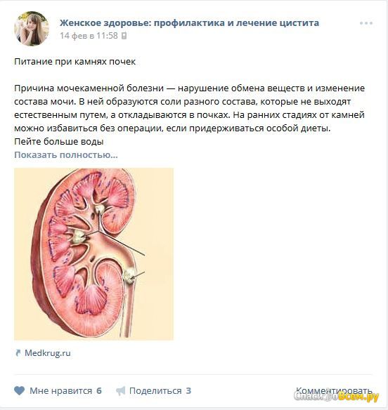 Группа Вконтакте "Женское здоровье: профилактика и лечение цистита"