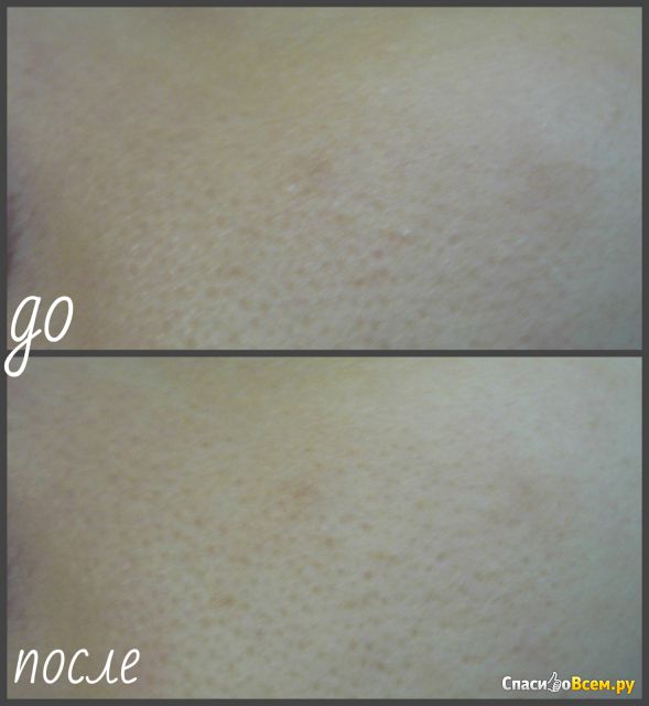 BB-крем Чистая линия Идеальная кожа Комплексный крем-уход с тонирующим эффектом 10 в 1 6 SPF