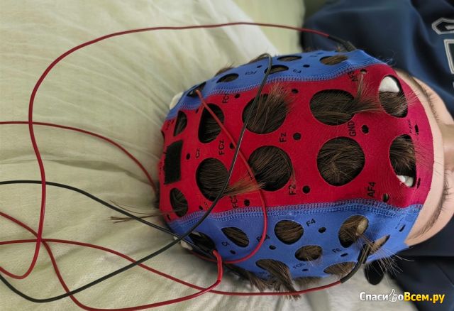 Микрополяризация головного мозга