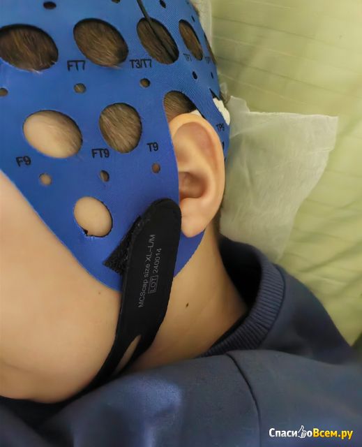 Микрополяризация головного мозга