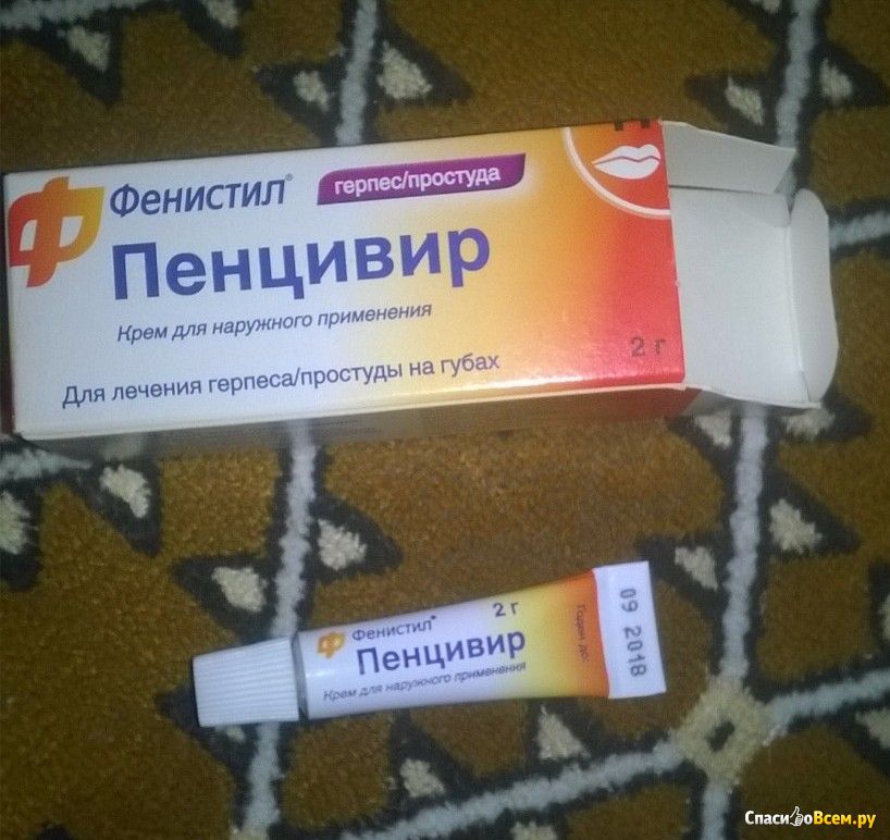 Отзыв про Крем Фенистил Пенцивир для лечения простуды на губах: 